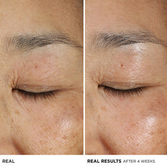 Confidence in an Eye Cream Anti-Aging Peptide Eye Cream